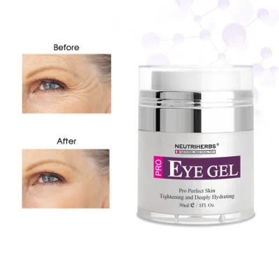 Amarrie Skincare Cosmetics Beauty Dark Circles Bag Removal Hydrating Eye Gel