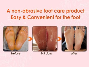 BRAPHY Foot Peeling off Mask for Foot Skin Care