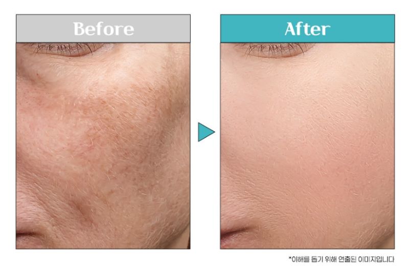 Glutathione Freckle Ampoule Mask Pack 