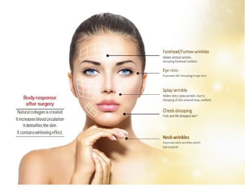 Gold Thread for beauty