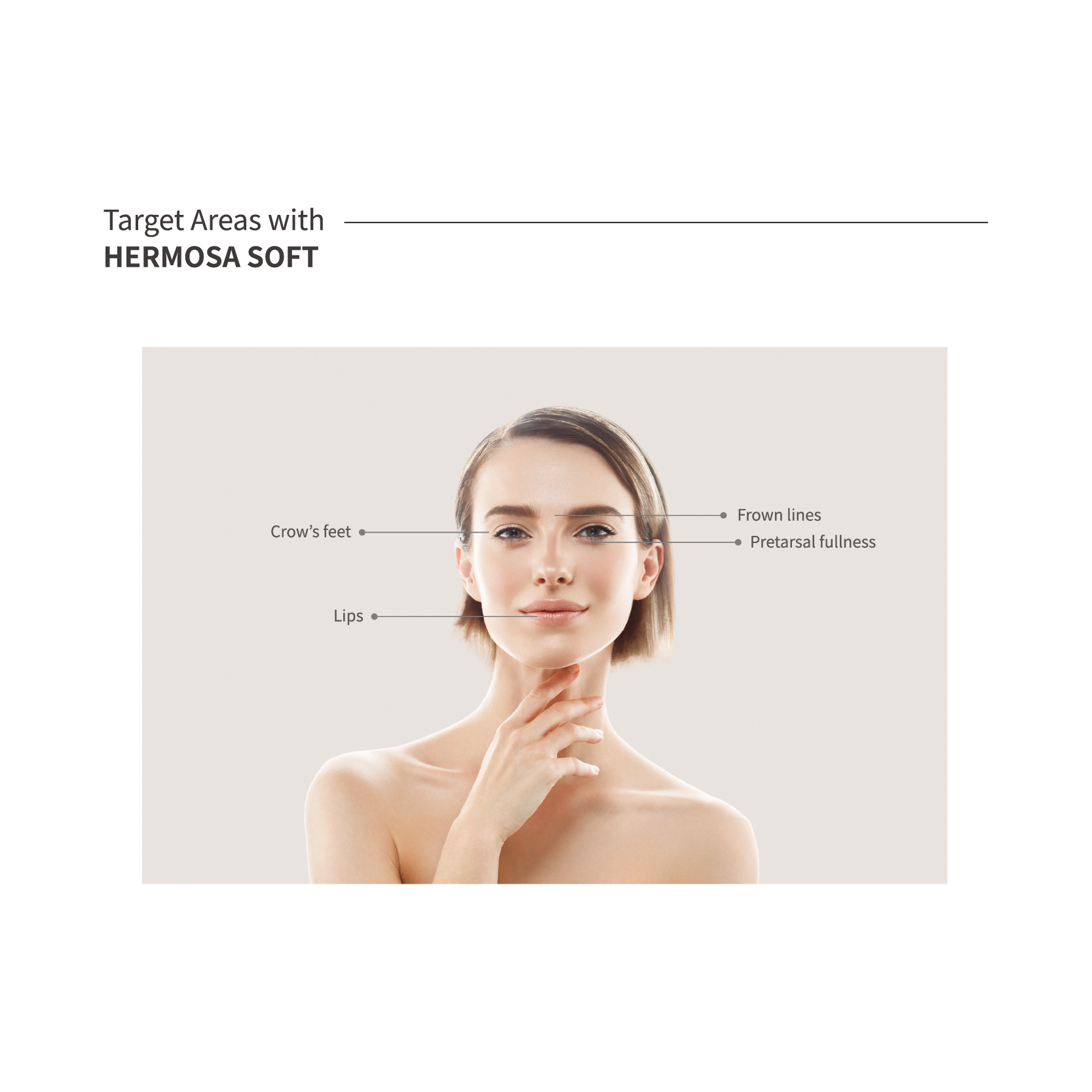 HERMOSA Dermal Filler_HARD/MILD/SOFT