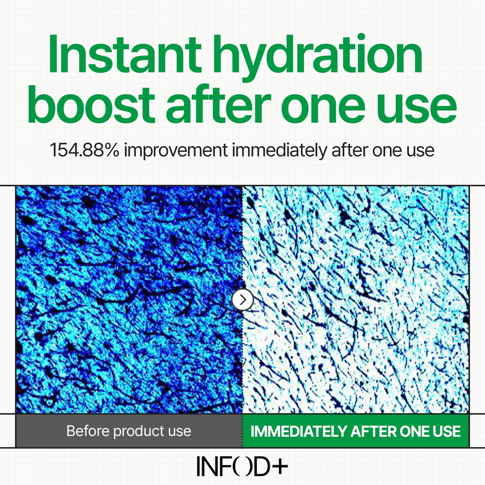 INFODPLUS XCESPI316™ HYDROVITA GEL PAD 70PADS