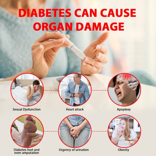 Sumifun Exfoliating Skin Care Cream - Body Care Lotion - Skin Care Ointment - Health K10129