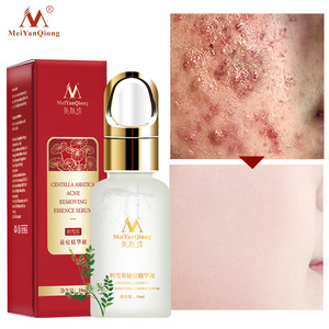 Acne removing essence serum Organic Skin Care Products Acne Scars Bio Essence Scar Removal EGF Serum