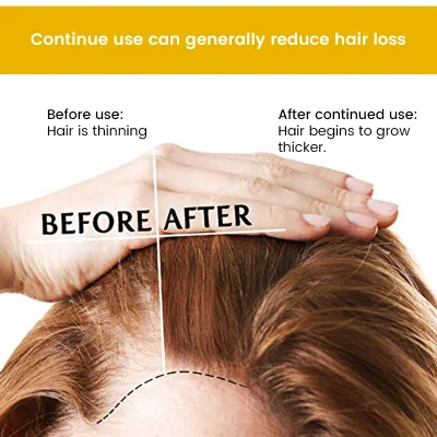 Hot Selling 100% Natural Extract Hair Care Product Anti Hair Loss Hair Growth Moisturizing Biotin Hair Shampoo & Conditioner